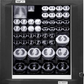 KND-A/Filme f-medizinische X Ray
