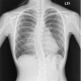 Tragbare weiße niedrige medizinische Filme X Ray, Röntgenstrahl-Papier-Film der medizinischen Bildgebung