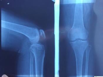 Blaue Diagnosedarstellung X Ray, medizinischer Laser-Papier-Röntgenstrahl-fotografischer Film