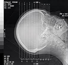 Diagnosedarstellung Silberhalogenid-Lasers X Ray, A3/A4 imprägniern Transparenz-Film