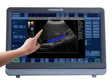 Medizinischer Doppler-Ultraschall-System Portable der Farbe3d/4D mit 15 Zoll LED Monitor