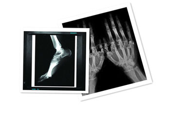 Hosipital-HAUSTIER Film medizinisches X Papier Ray imprägniern 8 Zoll ×10 CT-Film-Weiß