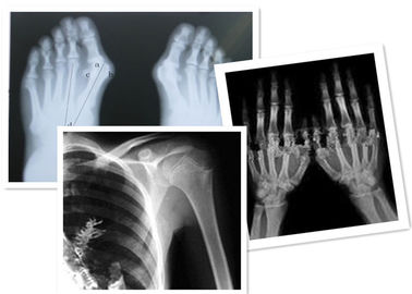 Thermischer Film Fuji Digital-X Ray medizinisch für Radiographie-Prüfung