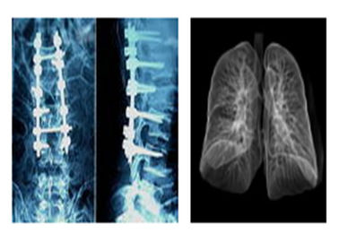 Scharfe radiografische medizinische Filme X Ray, Film Mri Dr.-Ct Digital Dry Imaging