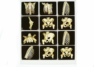 Tragbare weiße Diagnosedarstellung der Basis-X Ray, medizinischer Film Laser-blauer X Ray