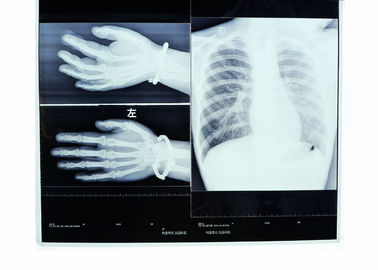 Darstellungs-Film-Digital-Röntgenstrahl Konida medizinischer trockener für Fuji-/Agfa-Drucker