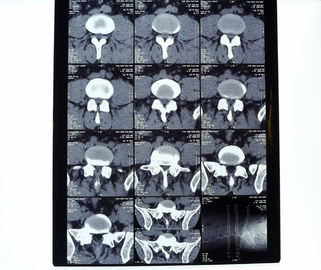 10in * 12in 11in * 14in mit hoher Dichte trockene Filme medizinischer Bildgebung für AGFA-/Fuji-Drucker