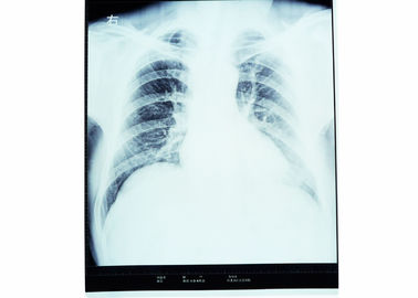 Hohe Schärfe-medizinische Diagnosedarstellung, trockener Film AGFA X Ray