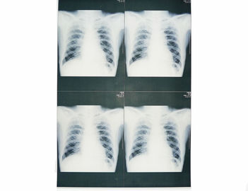 Tragbare weiße niedrige medizinische Filme X Ray, Röntgenstrahl-Papier-Film der medizinischen Bildgebung