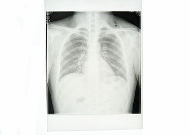 Weißer medizinischer Papierfilm-wasserdichte hohe Schärfe des kasten-X Ray