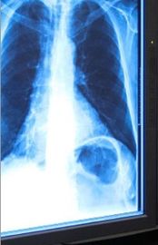 Film 11in x 17in der blauer Röntgenstrahl-trockener medizinischen Bildgebung für Thermal-Drucker