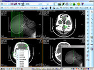 8 Papier-Lasers X Ray x 10inch medizinische Diagnosedarstellung für KND-DRYTEC 4000