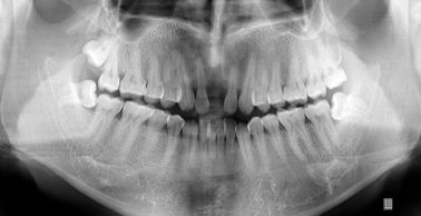 Good price Kundenspezifischer wasserdichter medizinischer Diagnosefilm der darstellungs-X Ray für Thermal-Drucker Online