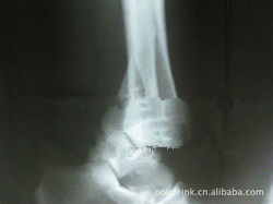 Good price Medizinische Bildgebung 8in x 10in Weißbuch-Lasers X Ray wasserdicht Online