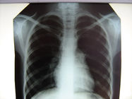 Krankenhaus-klarer medizinischer Röntgenfilm Konida mit Thermal-Druckern
