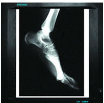 Good price 20cm x 25cm medizinische Diagnosedarstellung, Papier des Laserdrucker-Film-X Ray Online