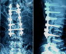 Good price Filme hohe Schärfe-medizinische X Ray Online