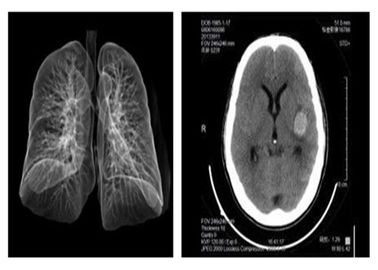 Good price Blaues HAUSTIER medizinischer Film 14 x 17in Agfa Drystar 5503 X Ray für Hosipital Online