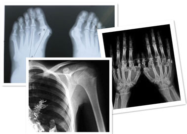 Good price Thermischer Film Fuji Digital-X Ray medizinisch für Radiographie-Prüfung Online