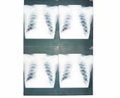 Weißer niedriger medizinischer Papier-Film X Ray feuchtigkeitsfest für Laserdrucker Sony-/EPSON