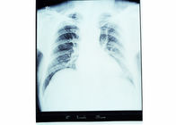 10 x 14 Röntgenstrahl-medizinischer trockener Darstellungs-Film-empfindliches Thermal für Fuji-Drucker