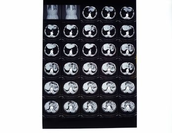 Drypix 2000 trockener Film X Ray 8 x 10 Zoll Scrach beständig für Fuji 3000