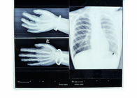 Niedriger Nebel 14in * 17in Röntgenstrahl-Transparenz-Thermal-Drucker Film medizinischer Bildgebung trockener