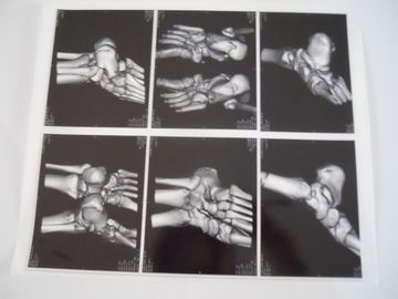 Good price Medizinischer trockener Darstellungs-Film für Prüfung X Ray auf AGFA 5300, 5302, 5500 Online