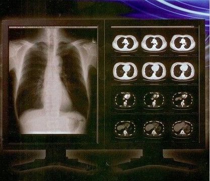 Heller klarer Film Digital-X Ray, Konida medizinischer Laser-Transparenz-Film