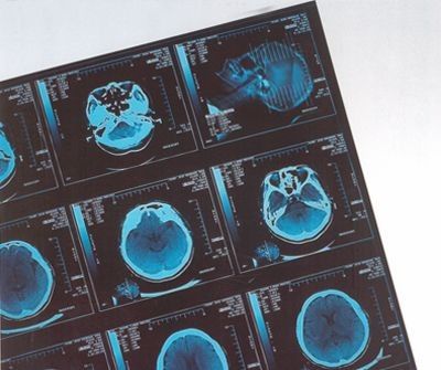 Trockenes Film-Thermal Digital-medizinisches X Ray für Krankenhaus CR/Dr