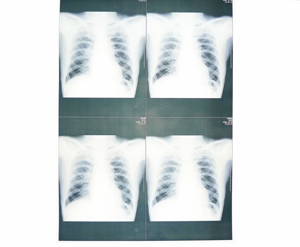 Weißer niedriger medizinischer Papier-Film X Ray feuchtigkeitsfest für Laserdrucker Sony-/EPSON