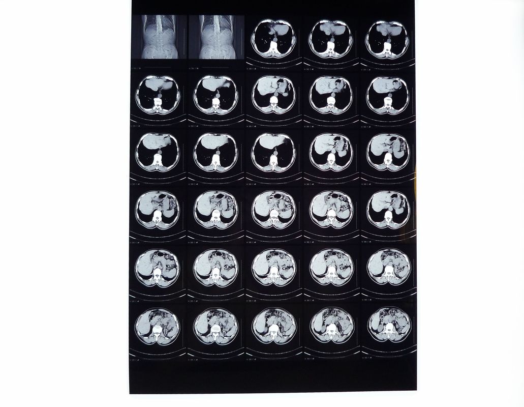 Medizinische x-Strahl Filme, trockener Darstellungs-Film kompatibel mit Thermal-Drucker für CT/Dr/MRI