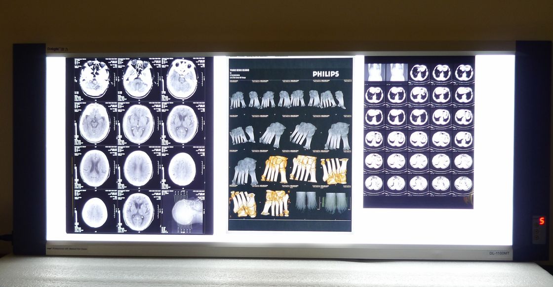 Hoher medizinischer Röntgenstrahl-trockener Transparenz-Film Schärfe Konida für AGFA-/Fuji-Drucker