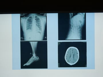Good price Film medizinischer Bildgebung Konida X Ray wasserdicht für Agfa-Drucker Online