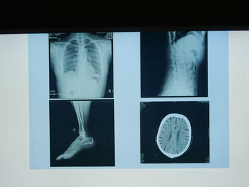 Film medizinischer Bildgebung Konida X Ray wasserdicht für Agfa-Drucker