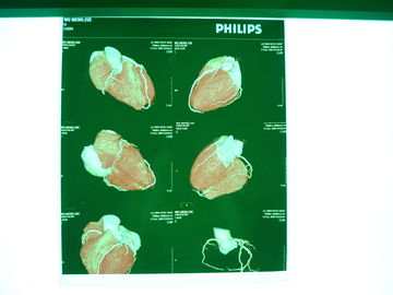 Good price Medizinischer trockener Film Digital-X Ray, Dt2b/medizinischer trockener Darstellungs-Film Dt1b Agfa Online