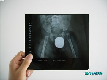 Good price Medizinische Bildgebung wasserdichtes dünnes Agfa DRYSTAR DT1B/DT2B Silberhalogenid-Lasers X Ray Online