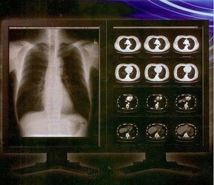 Good price Heller klarer Film Digital-X Ray, Konida medizinischer Laser-Transparenz-Film Online