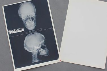 Good price Weißer medizinischer Papierfilm-wasserdichte hohe Schärfe des kasten-X Ray Online