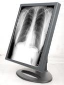 Good price Schnelle Getriebe-Grad-Anzeigen, medizinischer Grad zeigt G51SP an Online