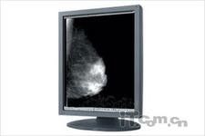 Medizinischer Grad LCD-Monitor-Anzeigen
