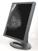 Good price Medizinischer Grad-Monitor-Anzeigen Online