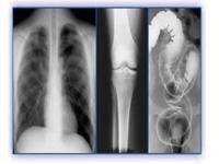 Good price Ganz eigenhändig geschrieber Film der medizinischen Bildgebung, Thermal-Drucker HAUSTIER X Ray Film Online