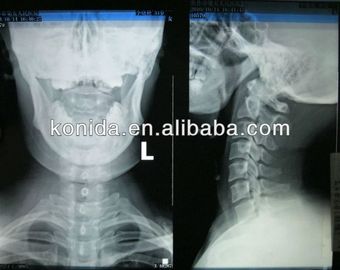 Good price Hohe Schärfe-medizinische Diagnosedarstellung, trockener Film AGFA X Ray Online