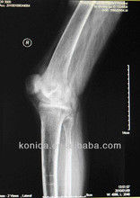 Good price Dauerhafte Diagnosedarstellung X Ray, 32cm x 43cm Film medizinisches Papier-Laser-blauer X Ray Online