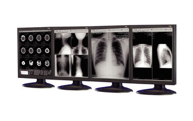 Anti-reflektierende medizinischer Grad-Anzeigen benutzt in der Ausrüstung der medizinischen Bildgebung
