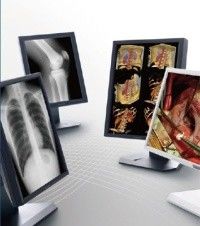Good price Klare Bild medizinischer Grad-Anzeigen, medizinische Anzeige der Graustufen-5MP Online