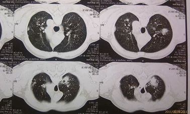 Umweltfreundlicher medizinischer trockener Film Agfa 2B X Ray mit CT-Maschine