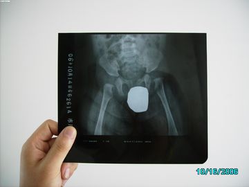 Niedriger Film-trockener Röntgenstrahl der Nebel-medizinischen Bildgebung für AGFA/Fuji/Kodak-Drucker