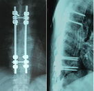 ein 8 x 10 Zoll-versah medizinisches trockenes Röntgenstrahl-Film-Doppeltes für AGFA Drystar \ mit Seiten